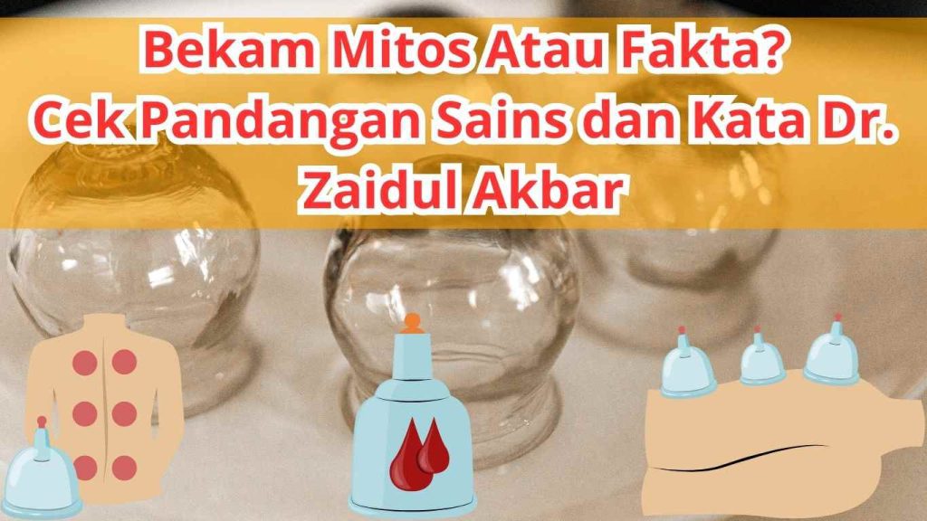 Mitos atau Fakta? Bekam Ternyata Punya Banyak Manfaat Menurut Sains dan Dr. Zaidul Akbar!
