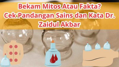 Read more about the article Mitos atau Fakta? Bekam Ternyata Punya Banyak Manfaat Menurut Sains dan Dr. Zaidul Akbar!